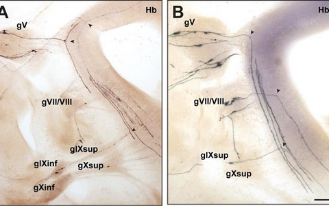 Bifurcation of axons from cranial sensory neurons depend on the receptor guanylyl cyclase Npr2