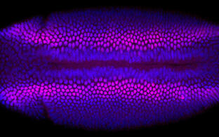 Stained fly embryo