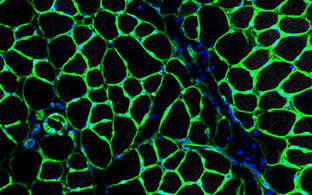 Green sponge-like network of mouse skeletal muscle