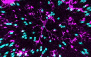 Microscopic image: Microglia with protein-coated latex balls