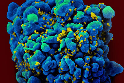 HIV-infected H9 T cell