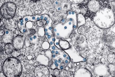 Viral Corona particles in an isolate