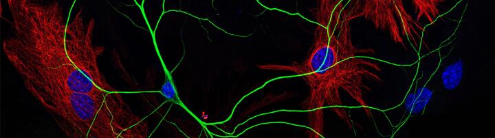 Ein einzelnes Neuron aus dem Kortex auf einem Rasen aus Gliazellen