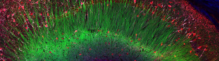 Schnitt durch den Hippocampus Schnitt durch den Hippocampus