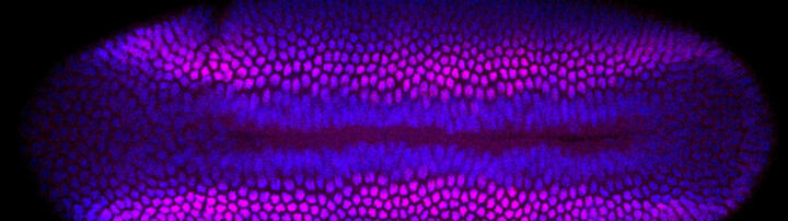 Stained fly embryo