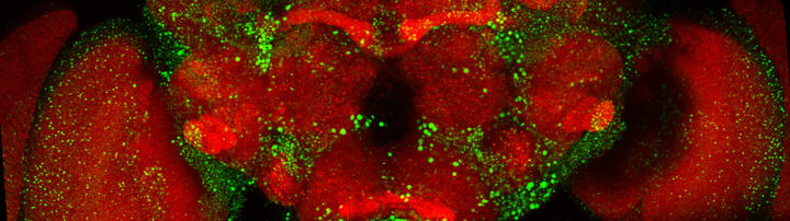 Transgenic fly brain with huntingtin aggregates Header Wanker Lab