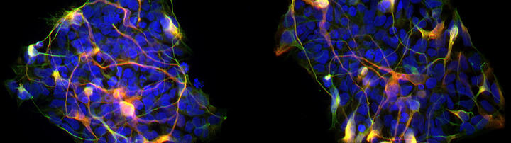 Neurons differentiating from colonies of neural progenitors