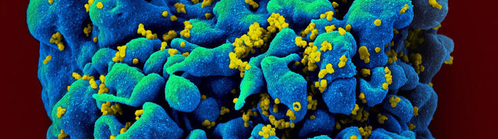 HIV-infected H9 T cell