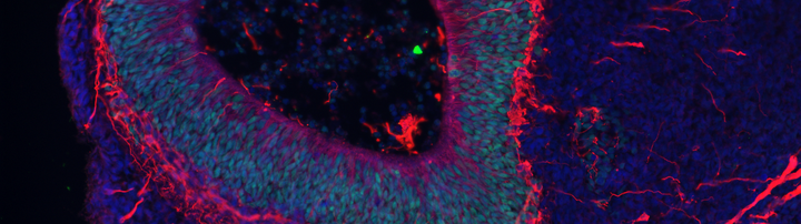 Organoid