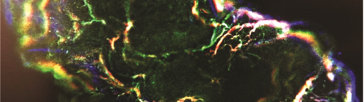 Heart and brain organoid