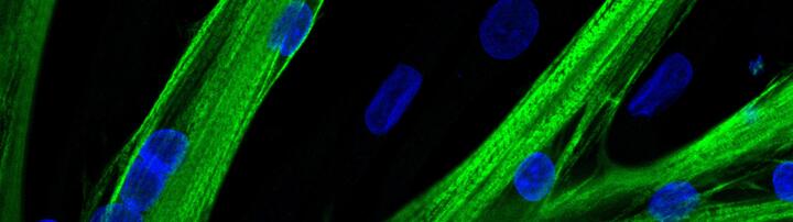 muscle stem cells fused into multinucleated myotubes