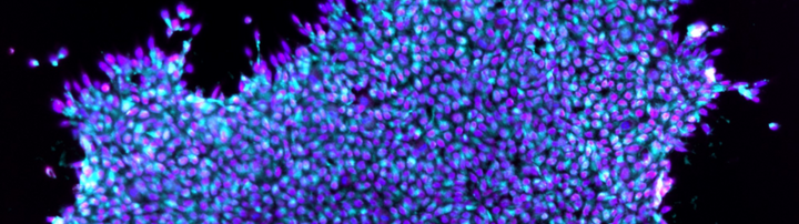 Pluripotent stem cells Pluripotent stem cells