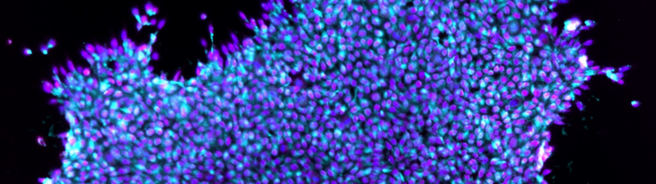 Pluripotent stem cells