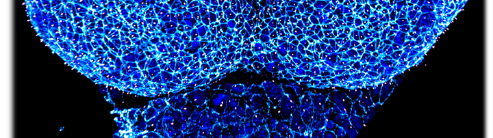 Neurulation stage mouse embryo Developing mouse forebrain
