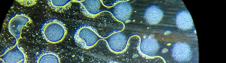 brain organoids through a microscope