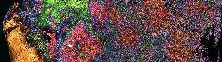 Tumor_MultiplexIF Tumor tissue