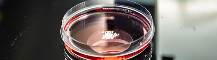 Organoids in petri dish