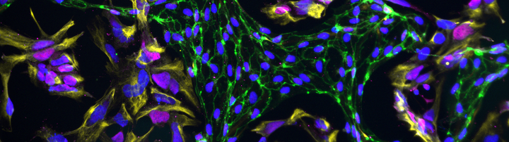 neuronal progenitors and endothelial cell co-cultures