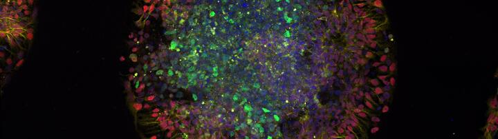 A day-old micropatterned organoid generated from induced pluripotent stem cells (iPSCs) derived from a patient with a mutation in the IRF2BPL gene. The different colors mark distinct cell populations, which reveal how the organoid is organizing into layers of developing neural tissue. It provides a snapshot of early human brain-like development in this patient-derived model.