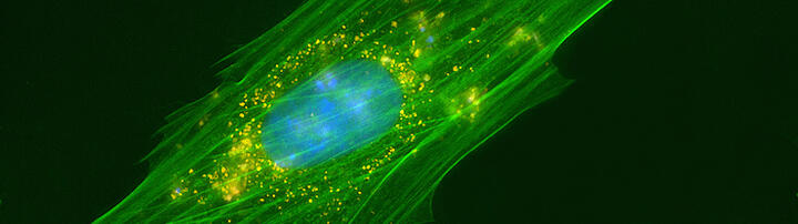 Protein degeneration in the heart Protein degeneration in the heart