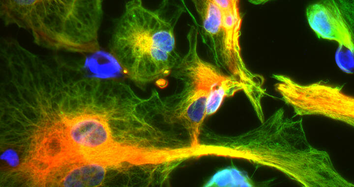 Best Scientific Images Contest: 2nd place for Gizem Inak