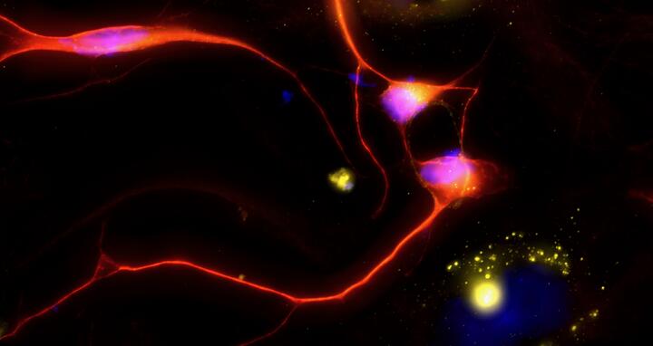 circRNAs (zirkul&auml;re RNAs) in neuralen Zellen