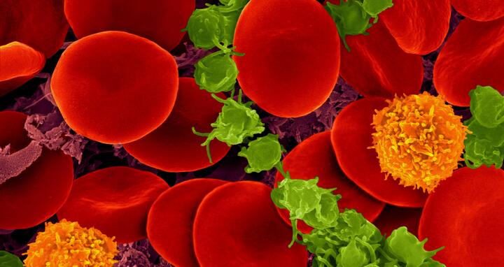 Human blood with red blood cells, T cells (orange) and platelets (green)