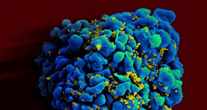 HIV-infected H9 T cell