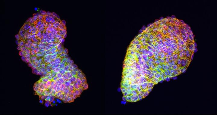 Zebrafish Heart Looping