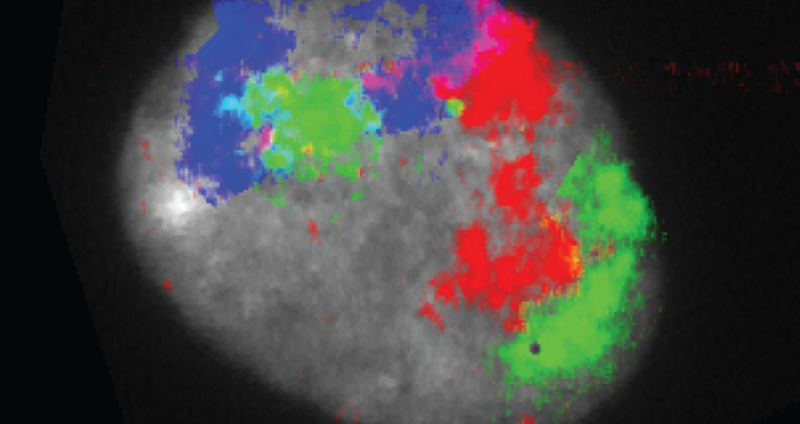 Chromosom 12