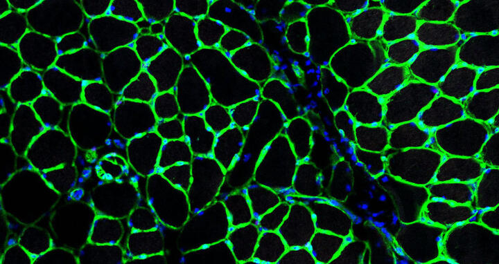 Green sponge-like network of mouse skeletal muscle