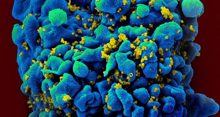 HIV-infected H9 T cell