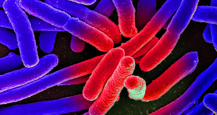 Escherichia coli under the microscope