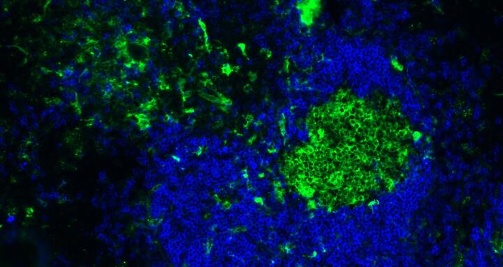 B2 cells in the spleen