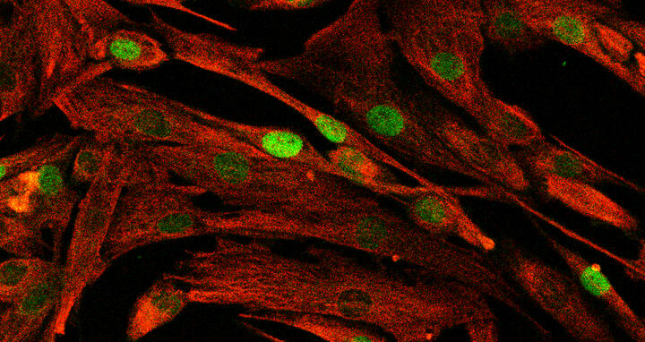 muscle cells