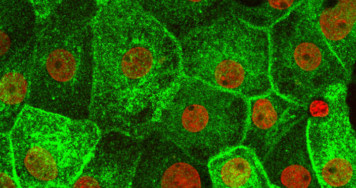 Fluconazole in rat kidney cells, AQP2 marked green
