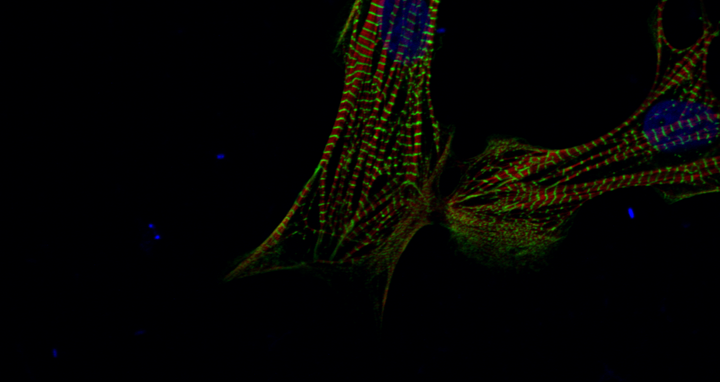 human cardiomyocytes that were derived from induced pluripotent stem cells