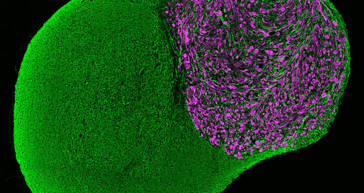 Neuromuscular_Organoid