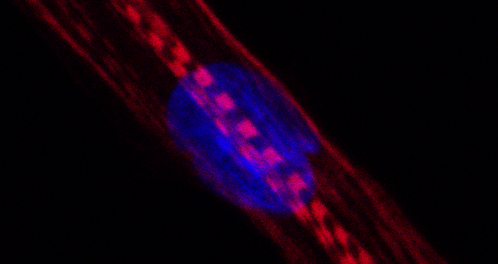 1643-MT-SkeletalMyosin.png