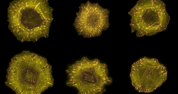 Aktinfasern und fokale Adh&auml;sionen