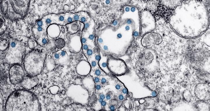 Viral Corona particles in an isolate