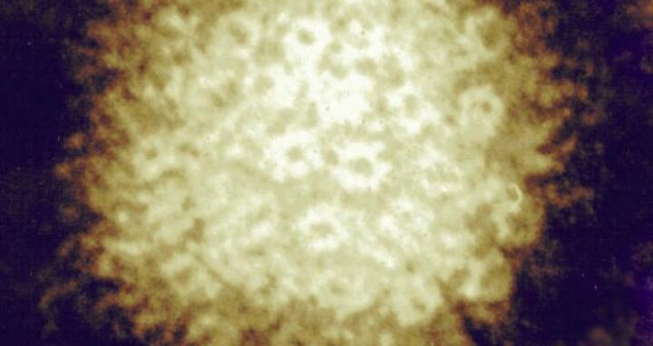 Herpes Virus