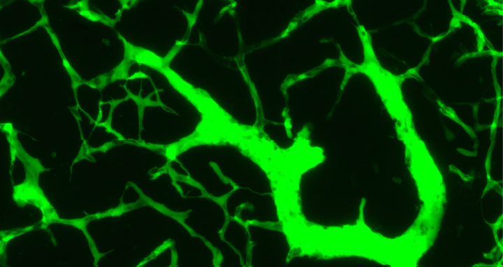 Lymph Nodes Blood Vessels