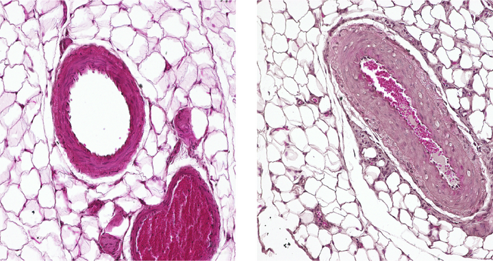 Arterien
