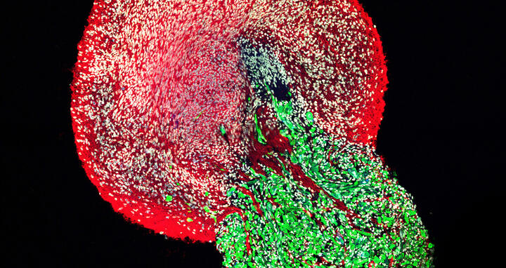 Organoids