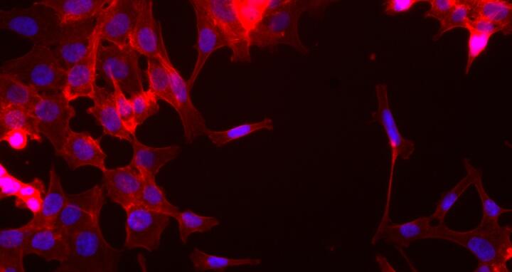 Cells leaving Primary Tumor