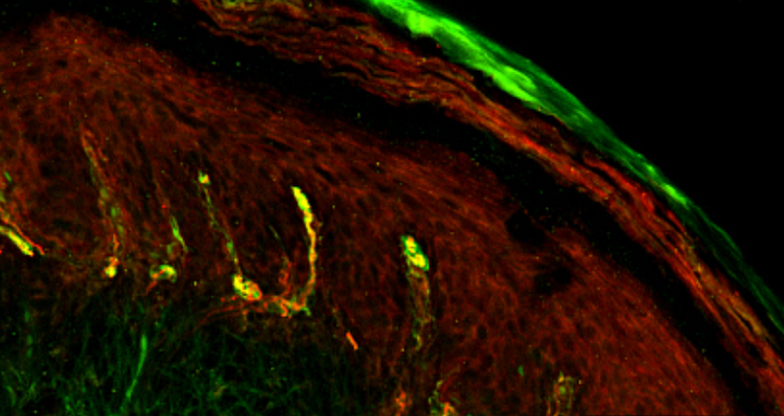 Header touch sensation Receptor