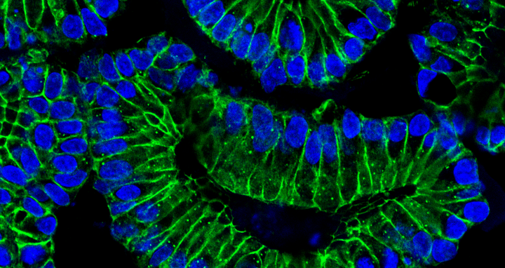 gastrointestinale Organoide