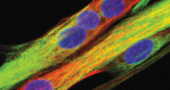 Menschliche Muskelzelle, wie sie aus Muskelstammzellen differenziert