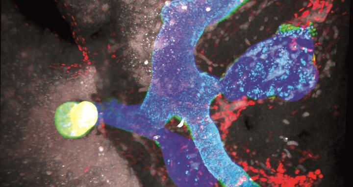 Lichtblattmikroskopischer Scan des hepatopankreatisch-biliären Systems und des Magen-Darm-Trakts eines Mausembryos